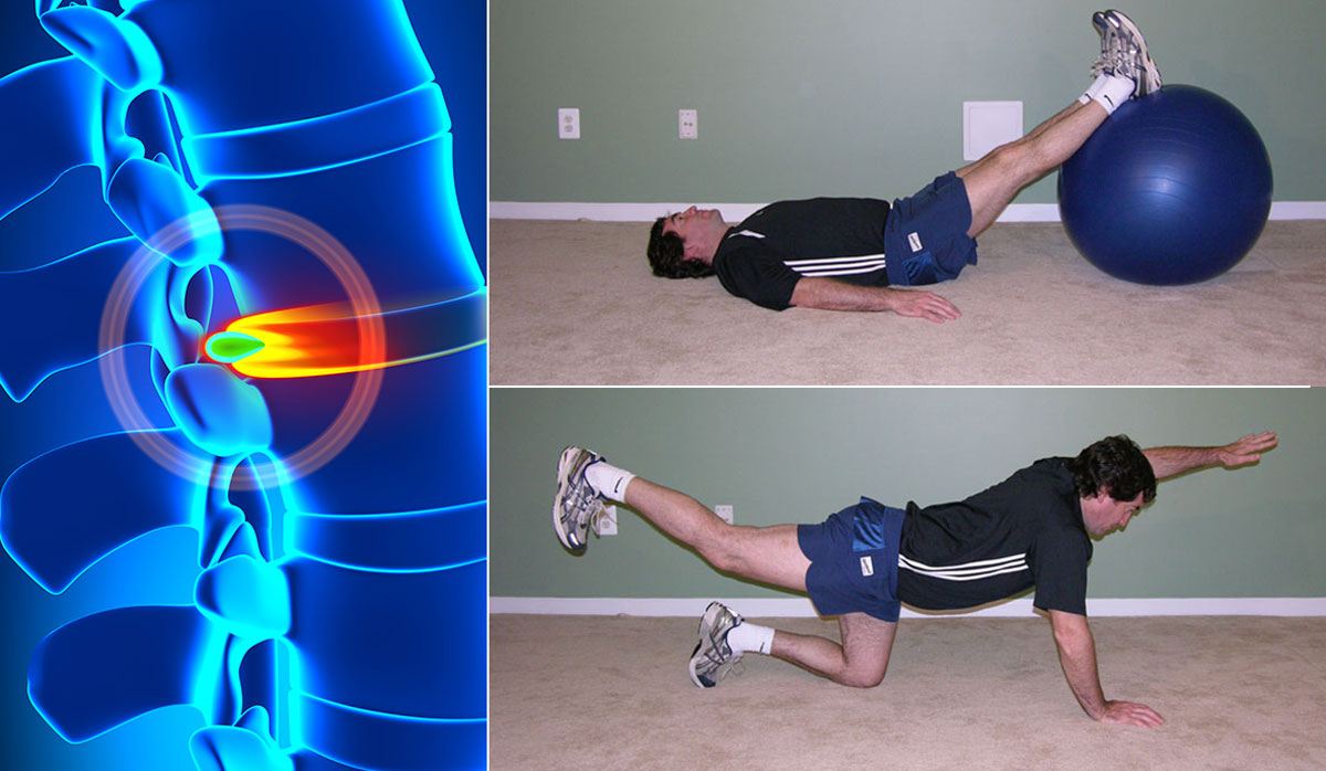 herniated-disc-exercises-easy-and-simple-moves-for-pain-relief