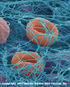 Fibrin Trapping Blood Cells