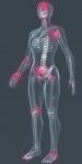 top symptoms of fibromyalgia