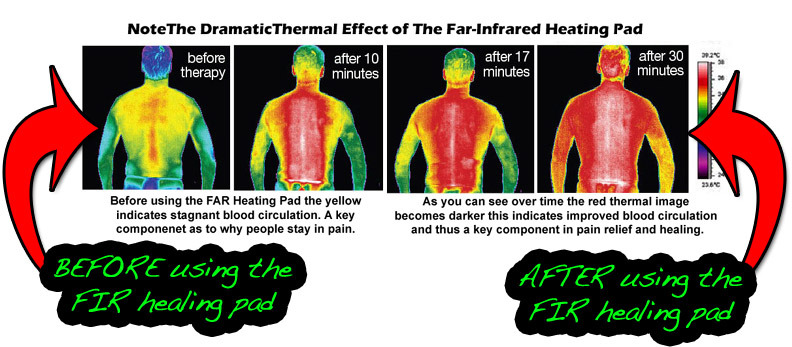 smoking increases back pain