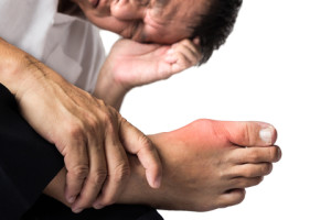 natural treatments for gout