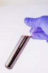 blood tube