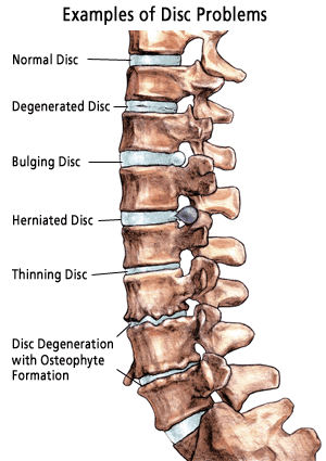 examples of disc problems