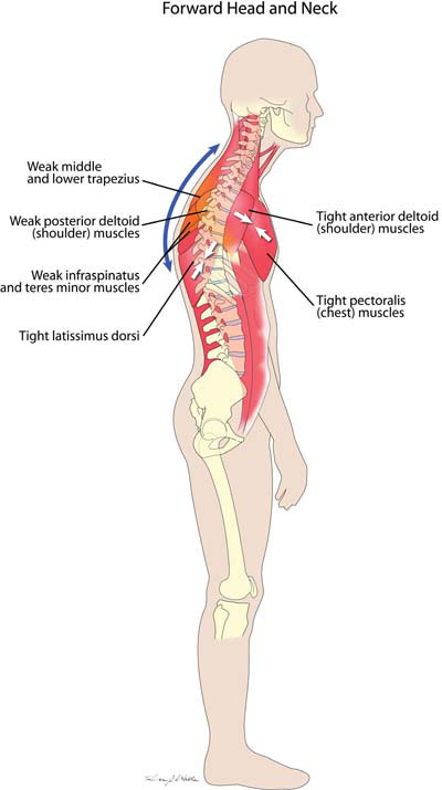 forward head and neck 