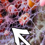 The #1 Hidden Cause of Joint Pain That You’ll Never Hear About From Your Doctor fibrin-mesh-w-arrow